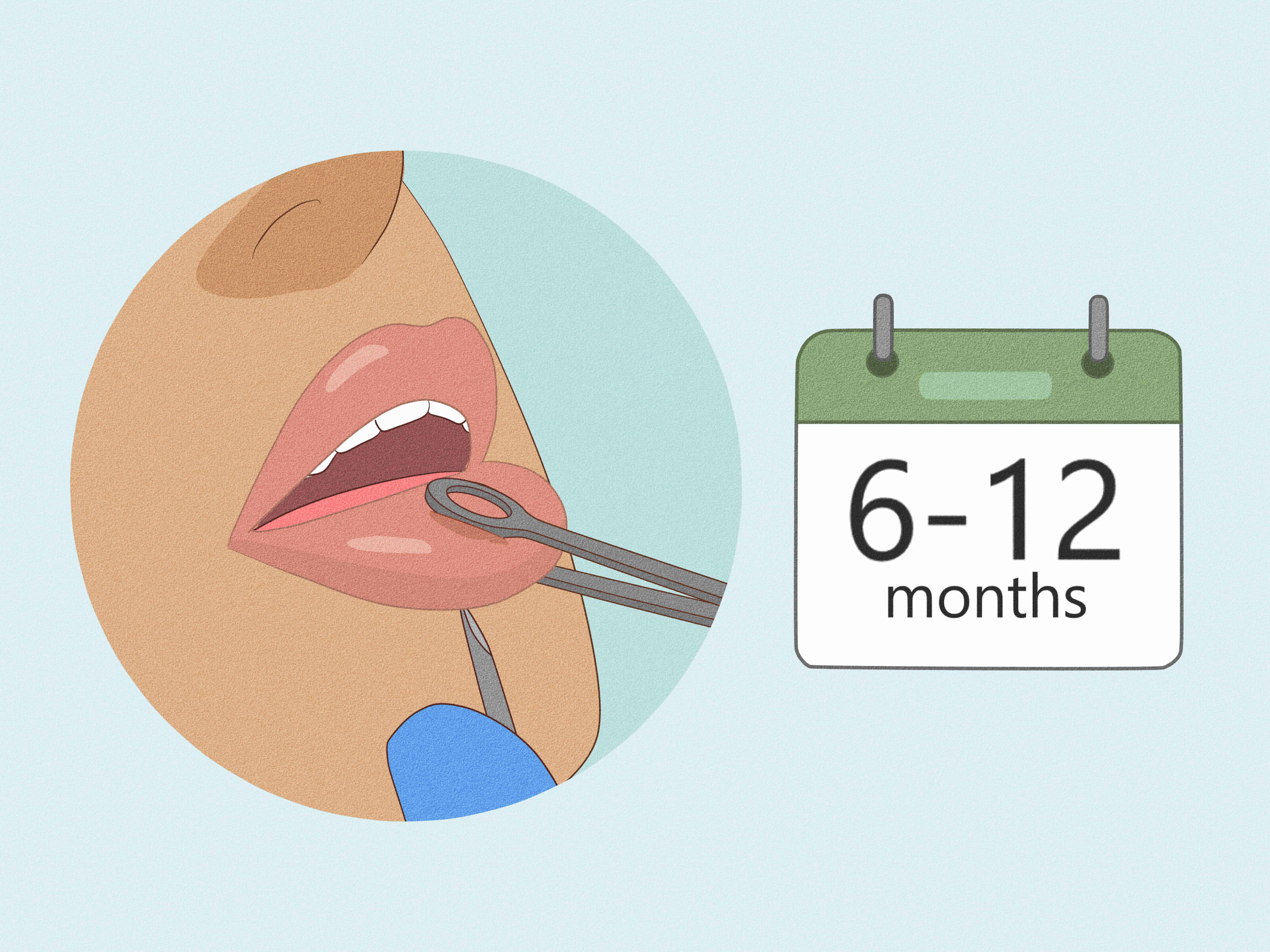 How to Keep a Piercing from Rejecting & What to Do If It Does