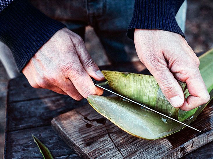 Aloe vera: Benefits and medical uses